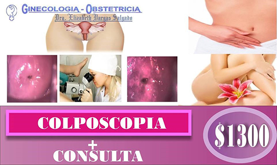 Colposcopia
